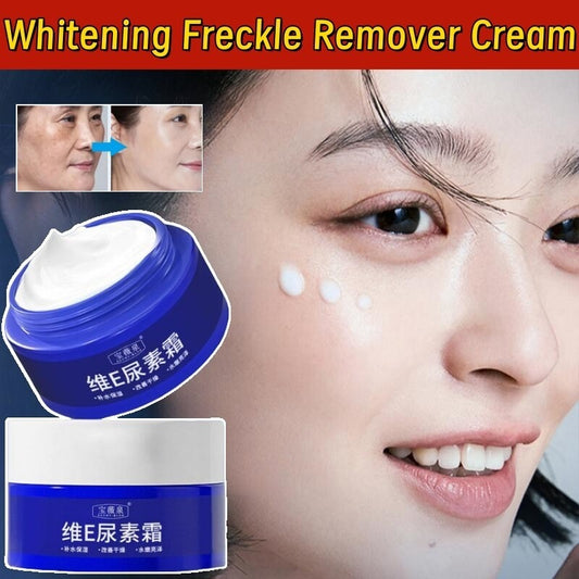 Spot Fading Urea Cream,Dark Spot Reducing Creams,𝐖𝐡𝐢𝐭𝐞𝐧𝐢𝐧𝐠 and 𝐅𝐫𝐞𝐜𝐤𝐥𝐞 Removal Reduce Dark Spots Cream
